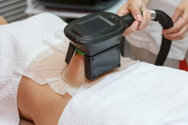Image of person having fat freezing treatment to help weight gain Burton upon Trent