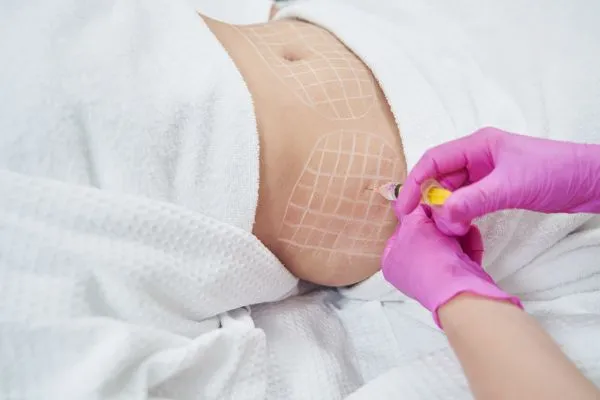 image of fat dissolving injections on love handles to help combat weight gain Burton upon Trent
