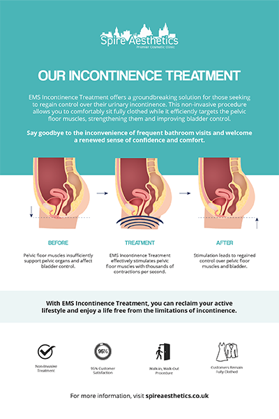 image to show how EMS treatment works for female urinary incontinence Burton upon Trent