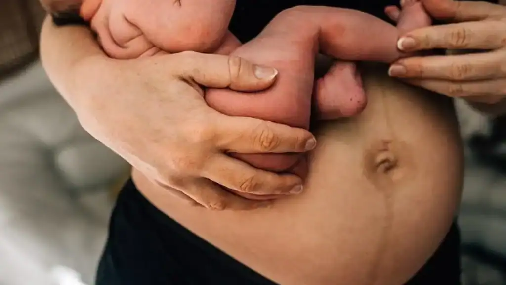 Why Is My Stomach Still Big After Pregnancy Burton upon Trent?